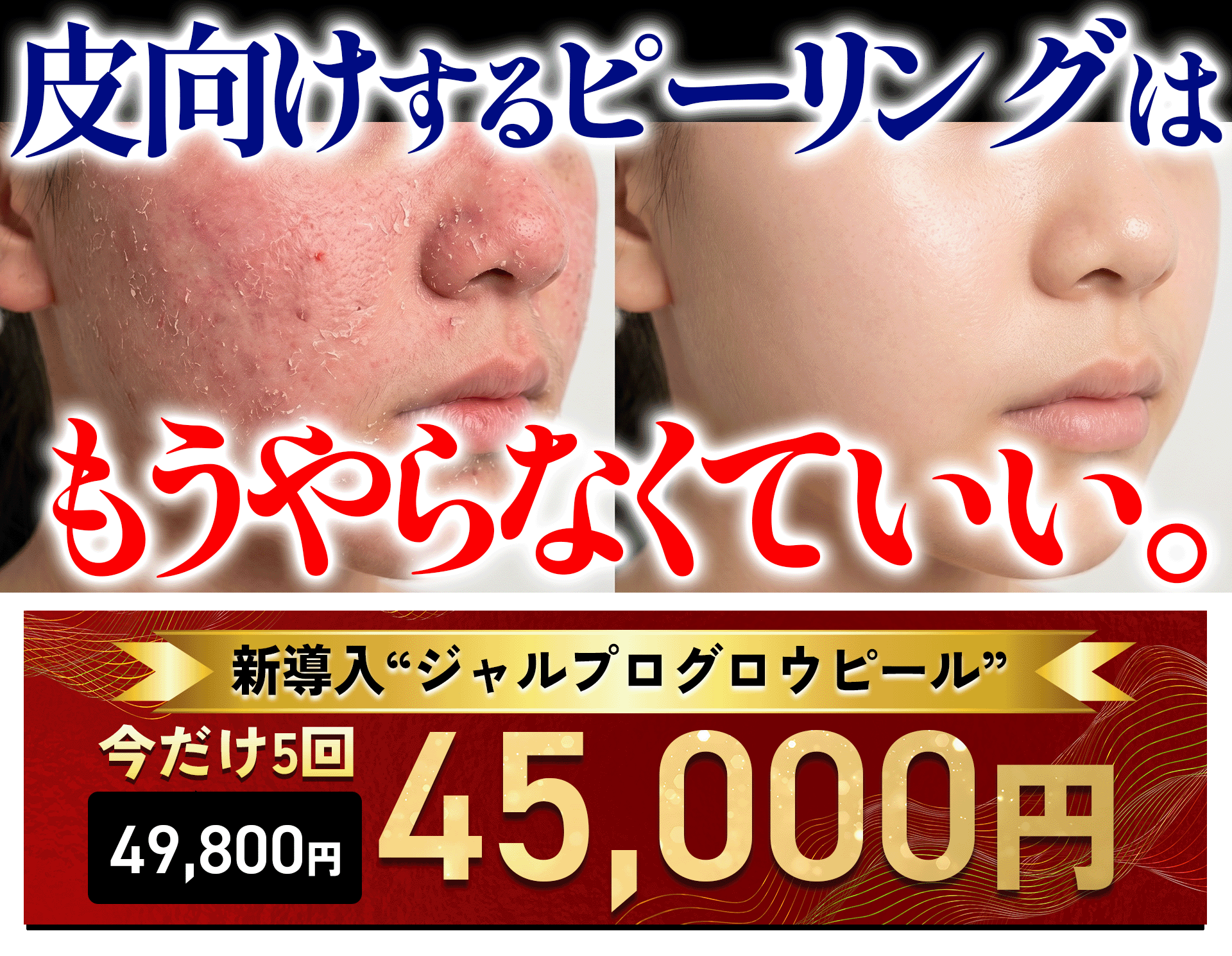 ジャルプロから新たにピーリングが新登場