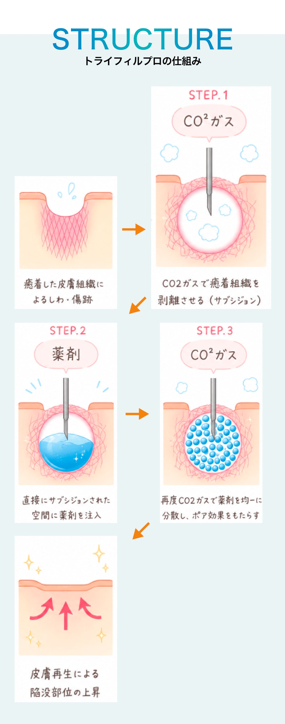 トライフィルプロの仕組み