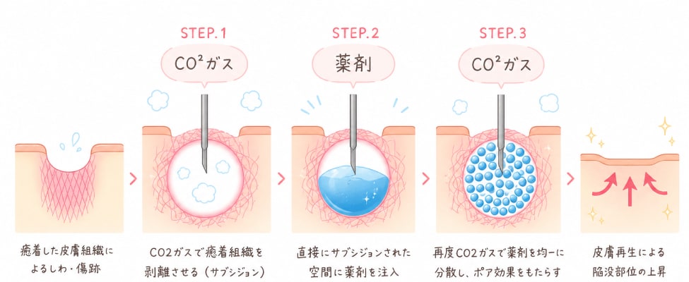 トライフィルプロが「根っこ」に効く理由