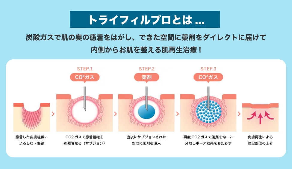 ひと言で言うと「肌を内側から整える治療」