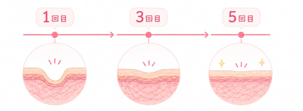 回数を重ねるごとの変化、目安はこんな感じ