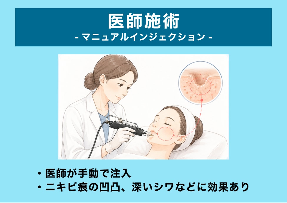 医師施術コース――ピンポイントにアプローチ
