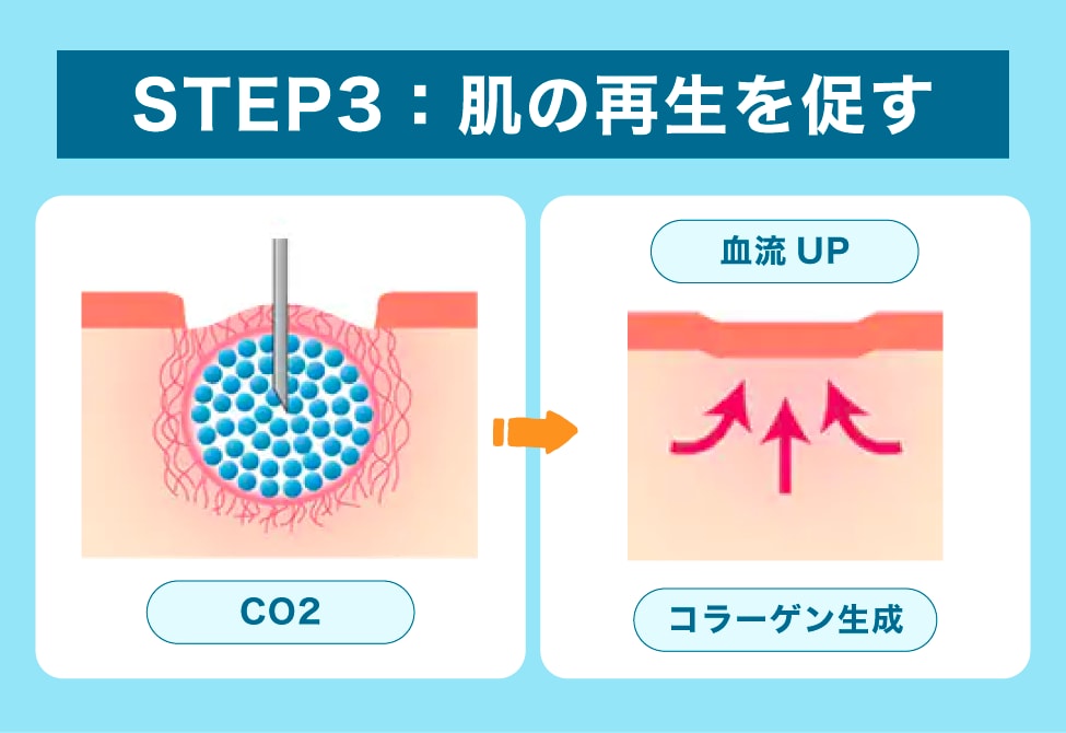 ステップ③ 再生させる――体が自然に修復モードへ