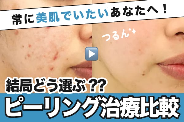 【徹底比較】ピーリング治療の違いとは？肌悩み別の選び方を解説｜千葉センシティ院
