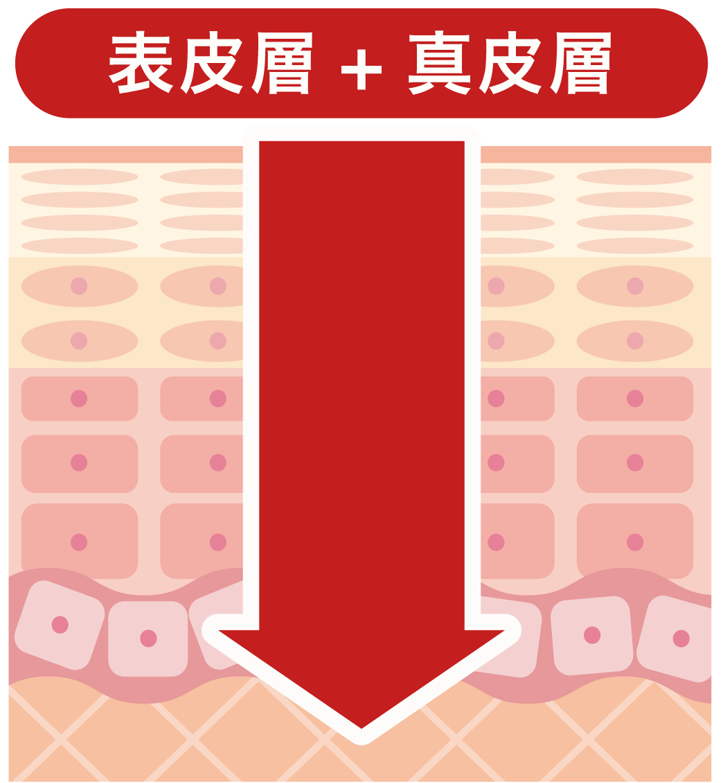 ララドクターが届く層