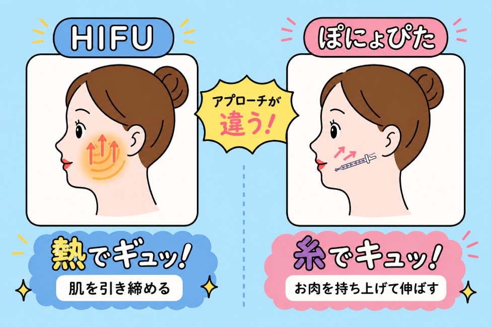 「アプローチの仕組みと目的」の違い