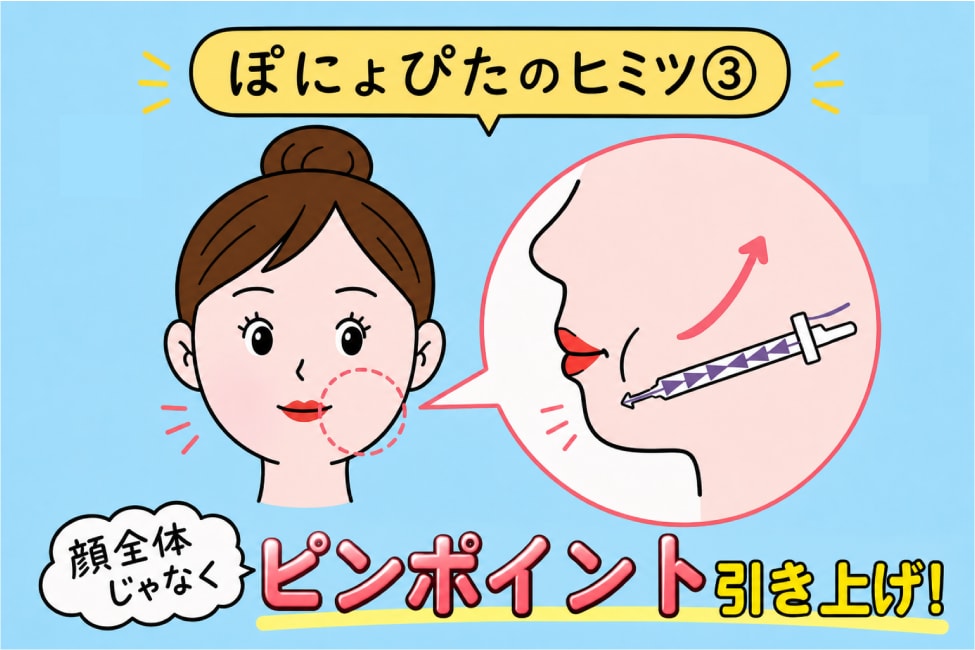 ピンポイント固定でひきつれにくい