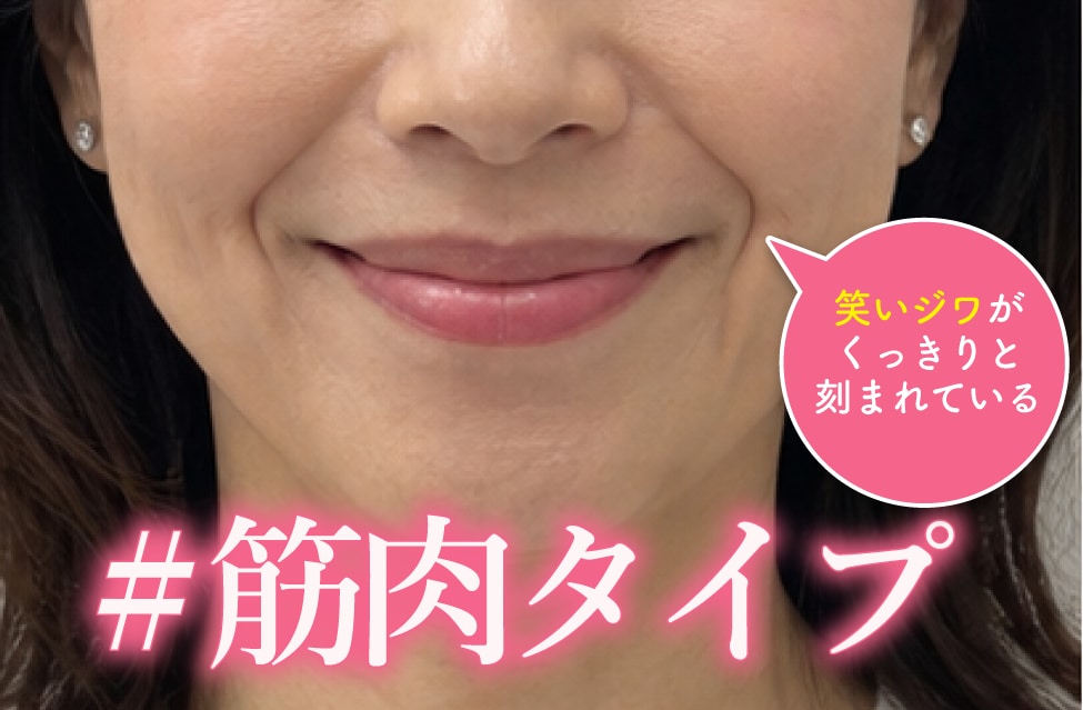 筋肉タイプ