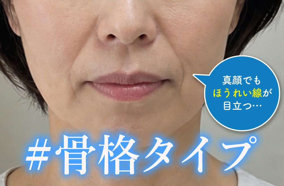骨格タイプ