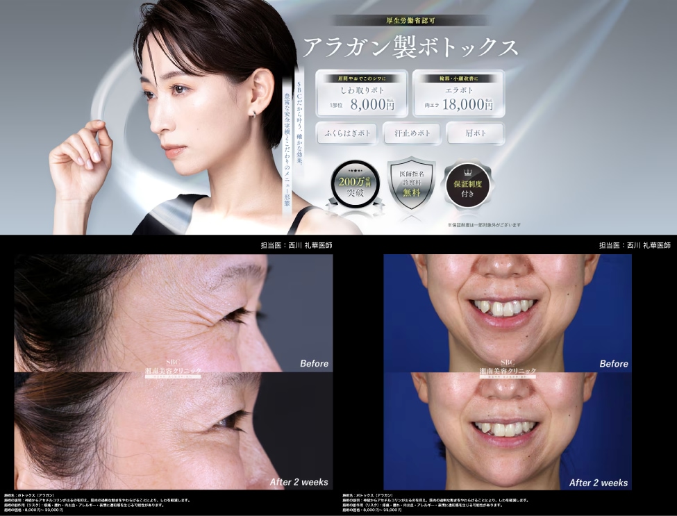 ⑤ 表情じわが気になり始めたら「ボトックス」