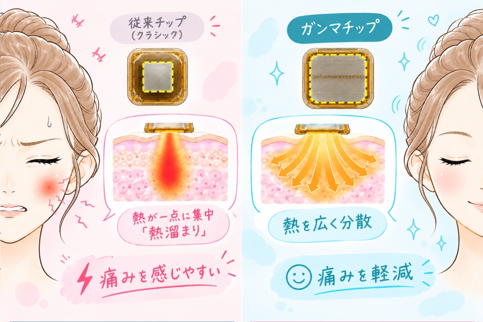 ② 熱をふわっと分散！刺すような「痛みが軽減」