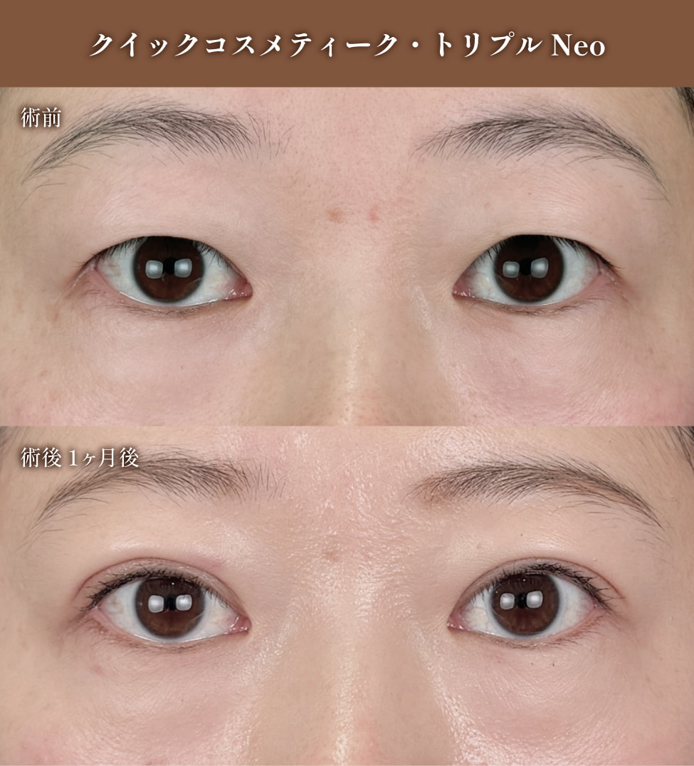 30代：「変化の兆し」をリセットし、パッチリ感を復活