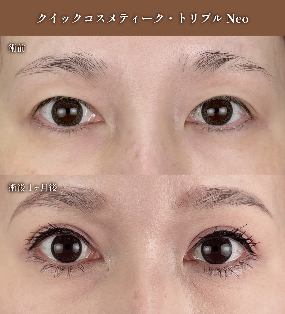 40代：「たるみ」による疲れ顔・老け見えを解消