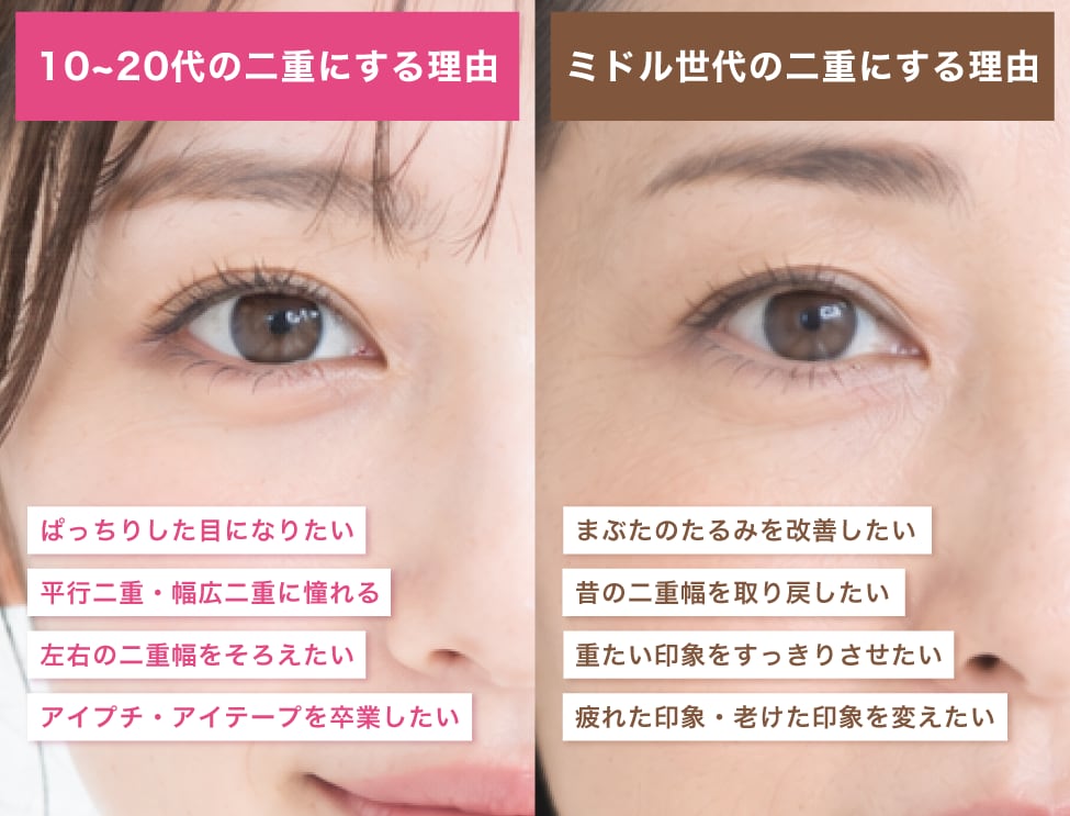 エイジングケアとしての二重整形