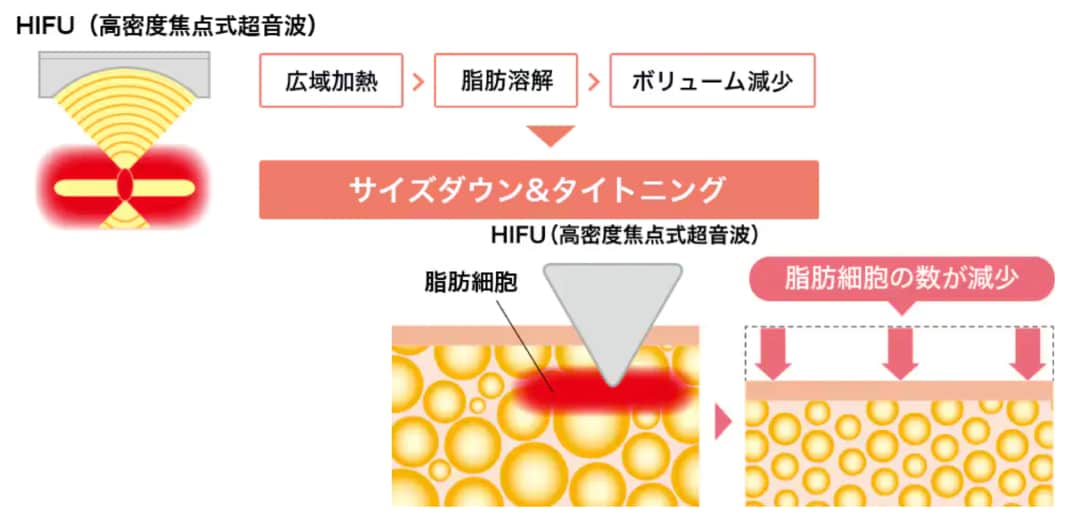 なぜ手術のように顔の表面を傷つけることなく治療できるのか？