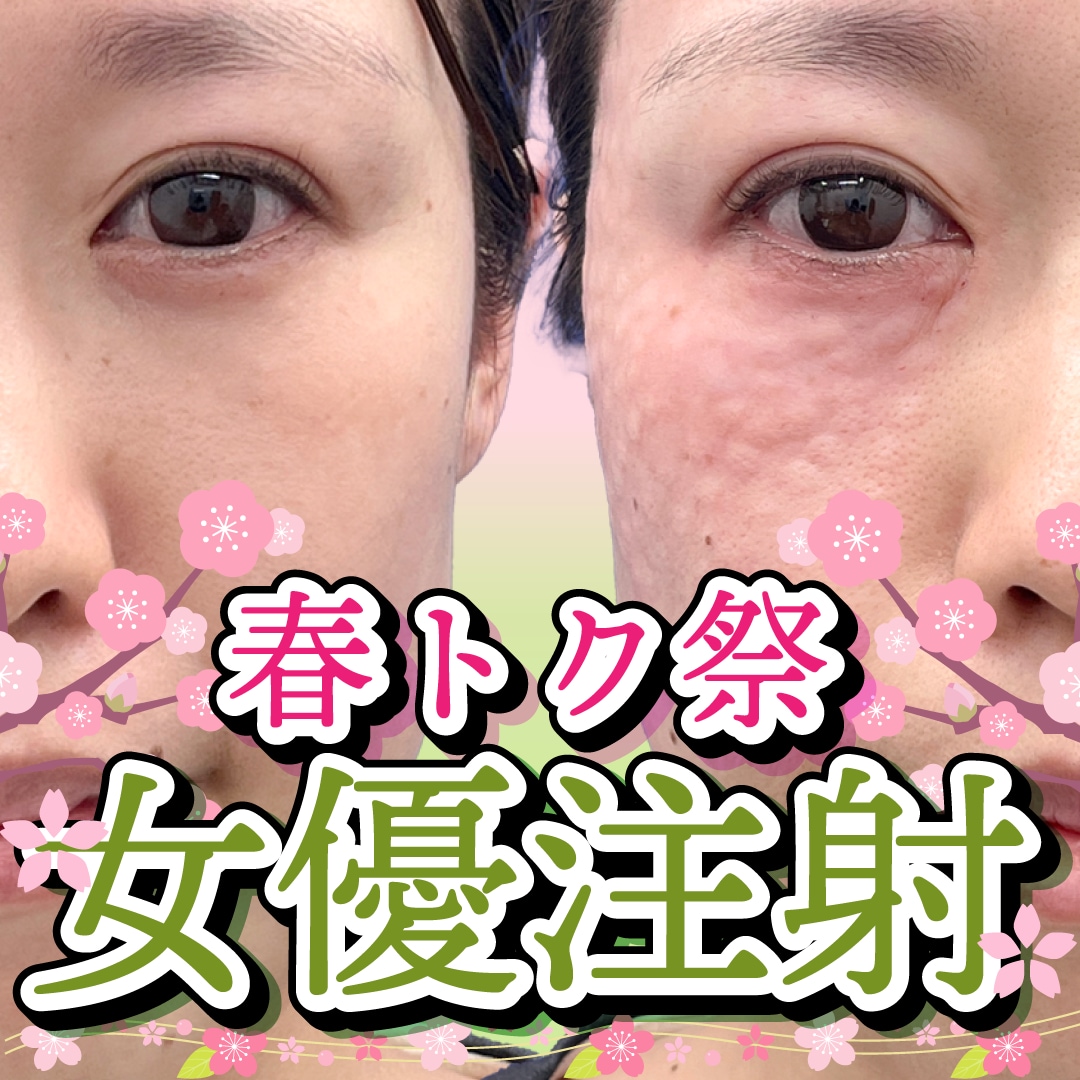 艶＆ハリのぷりぷりつるん肌が目指せる女優注射って何？