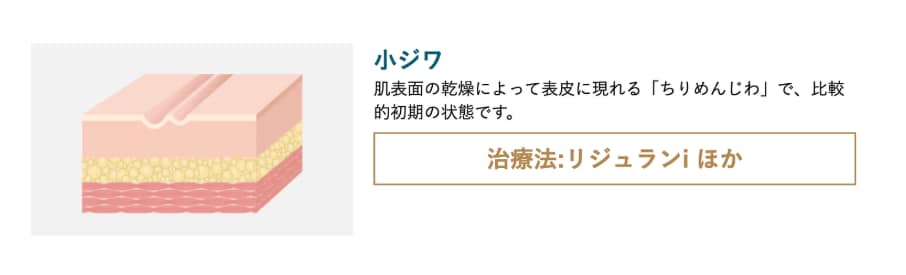 小じわ改善におすすめの施術は?