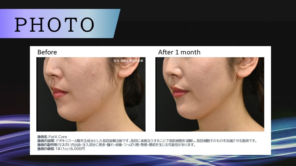 1回でも効果あり！