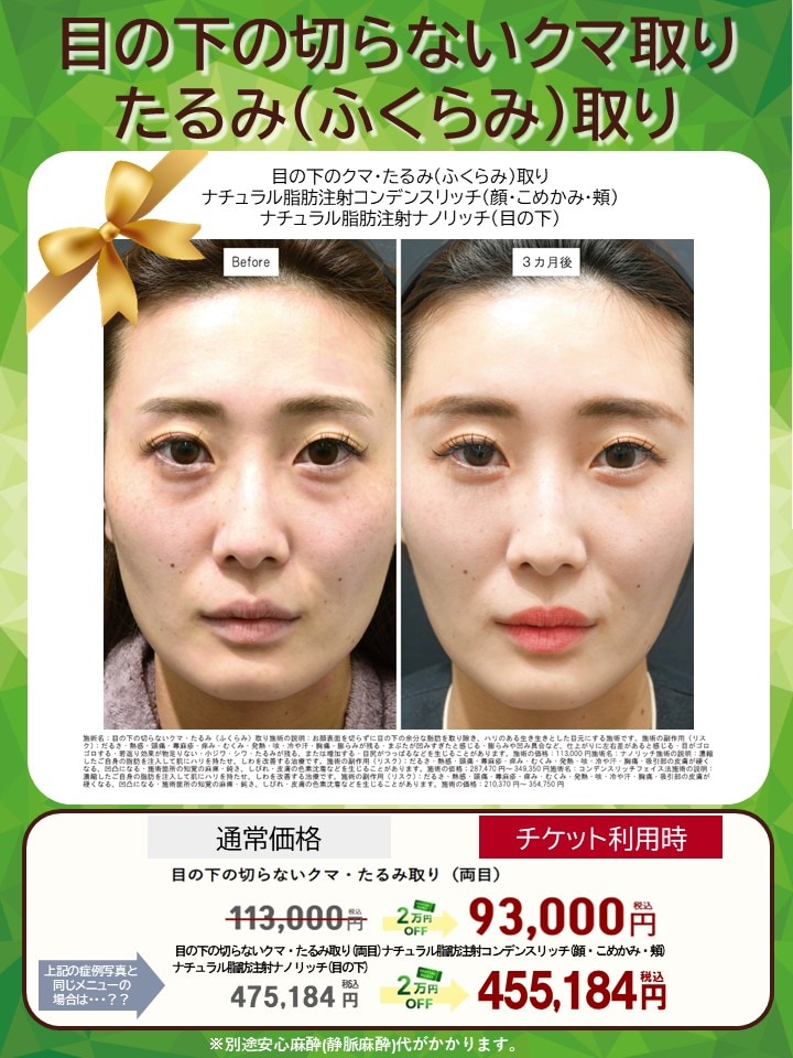 2万円OFFになるといくらになる…？