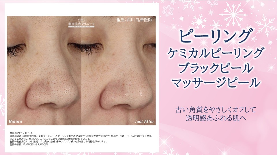 ⭐ピーリング⭐