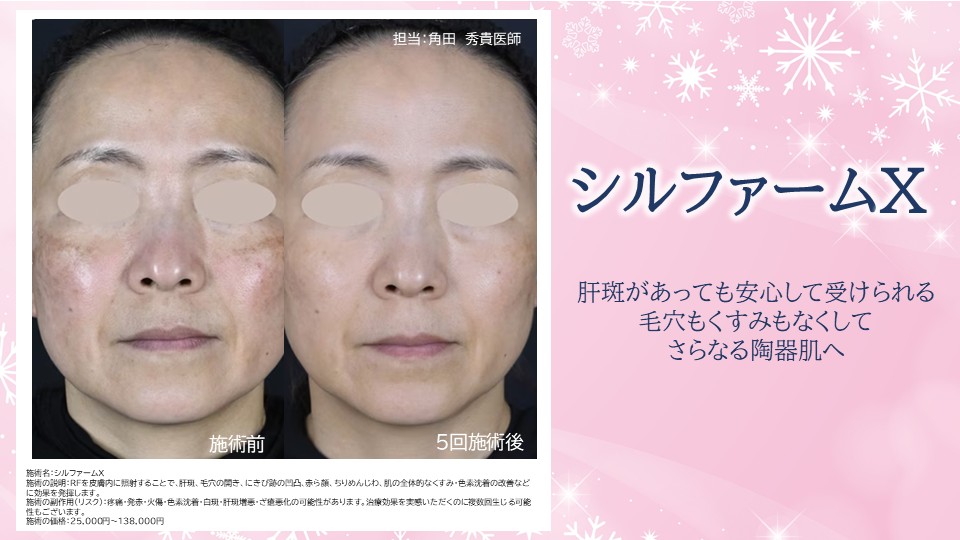 ⭐シルファームX⭐