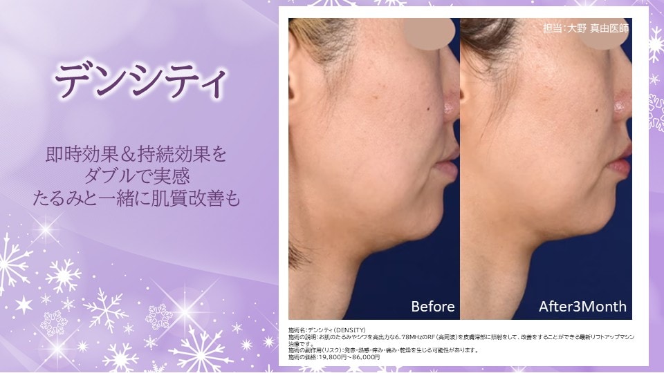 ⭐デンシティ⭐