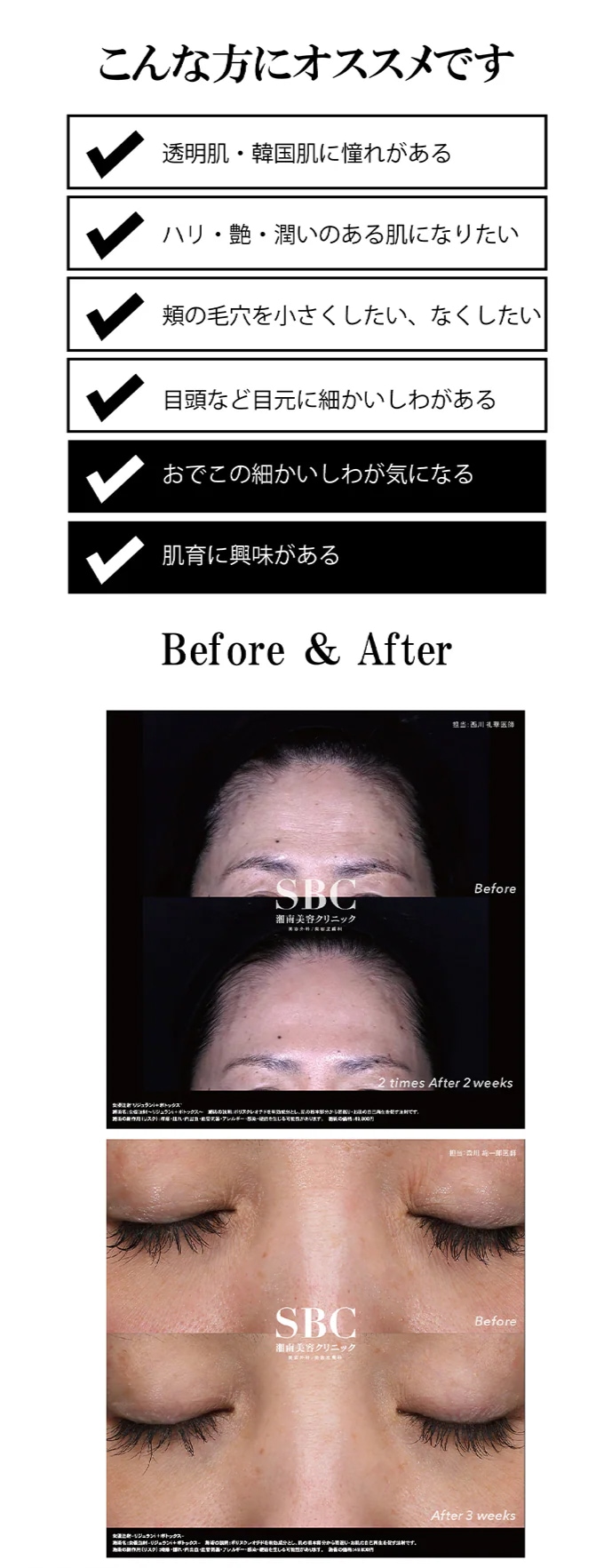 つるつるおでこや潤い・艶のある透明肌、小ジワのない目元が目指せます。