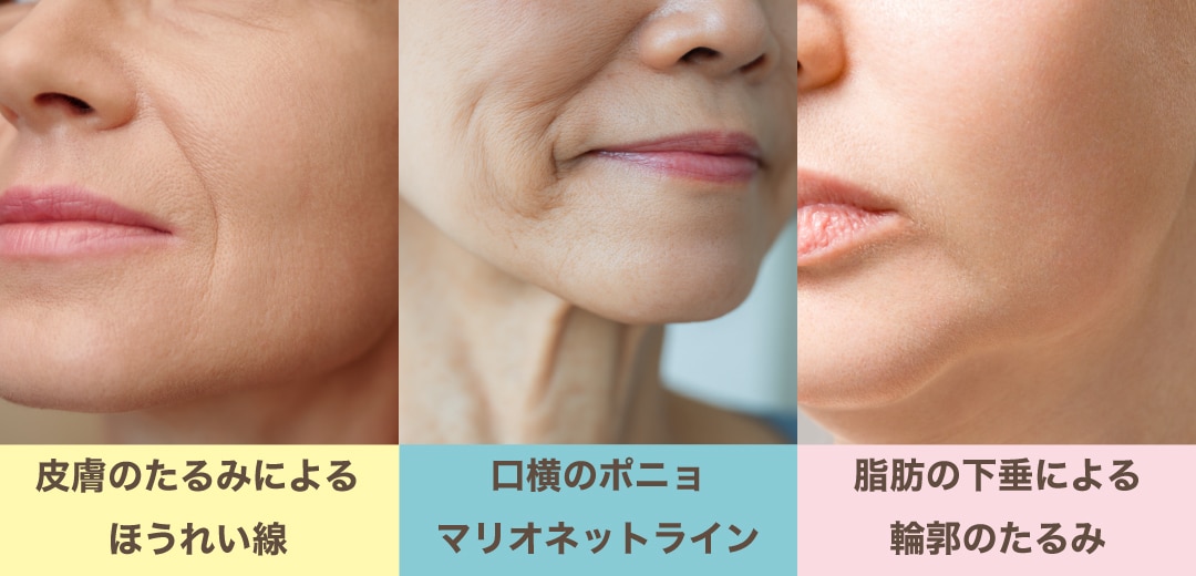 最もたるみやすいのは・・・