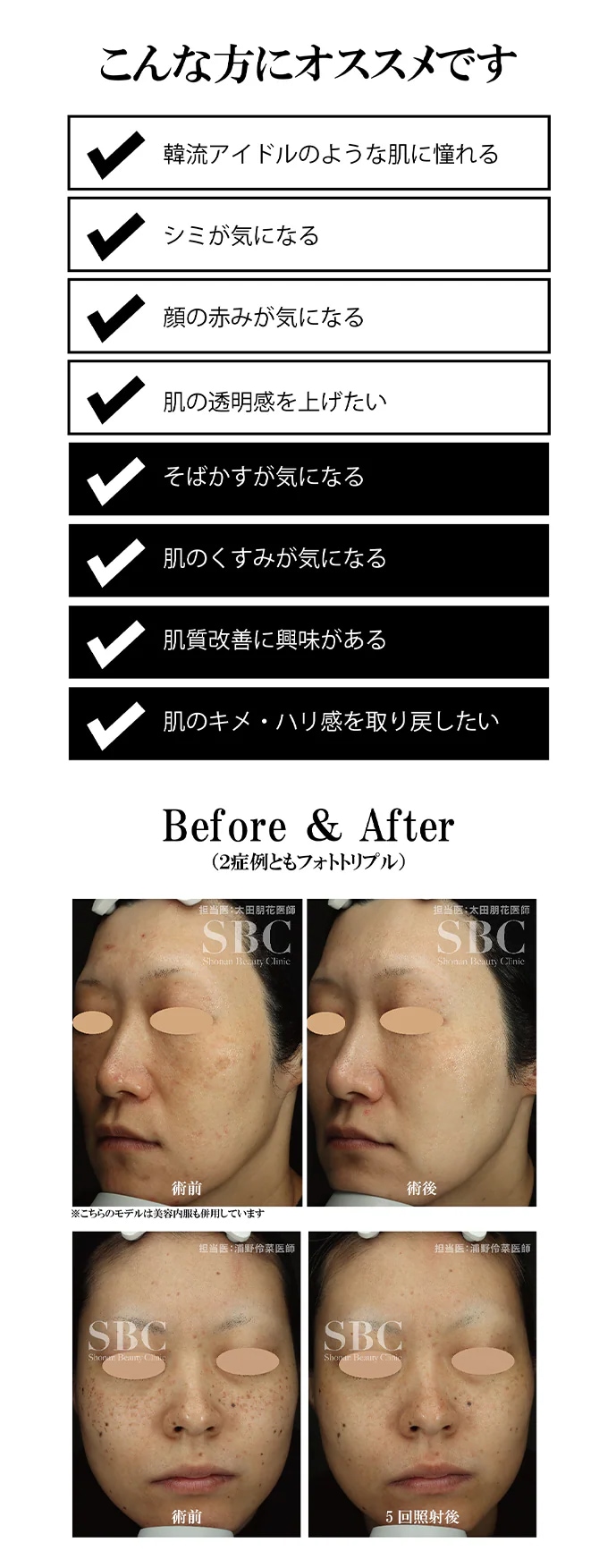 それはまるで、韓流ドラマで見たような桁違いの透明感。シミや赤みなどの色ノイズがない、均一な肌を目指せます。