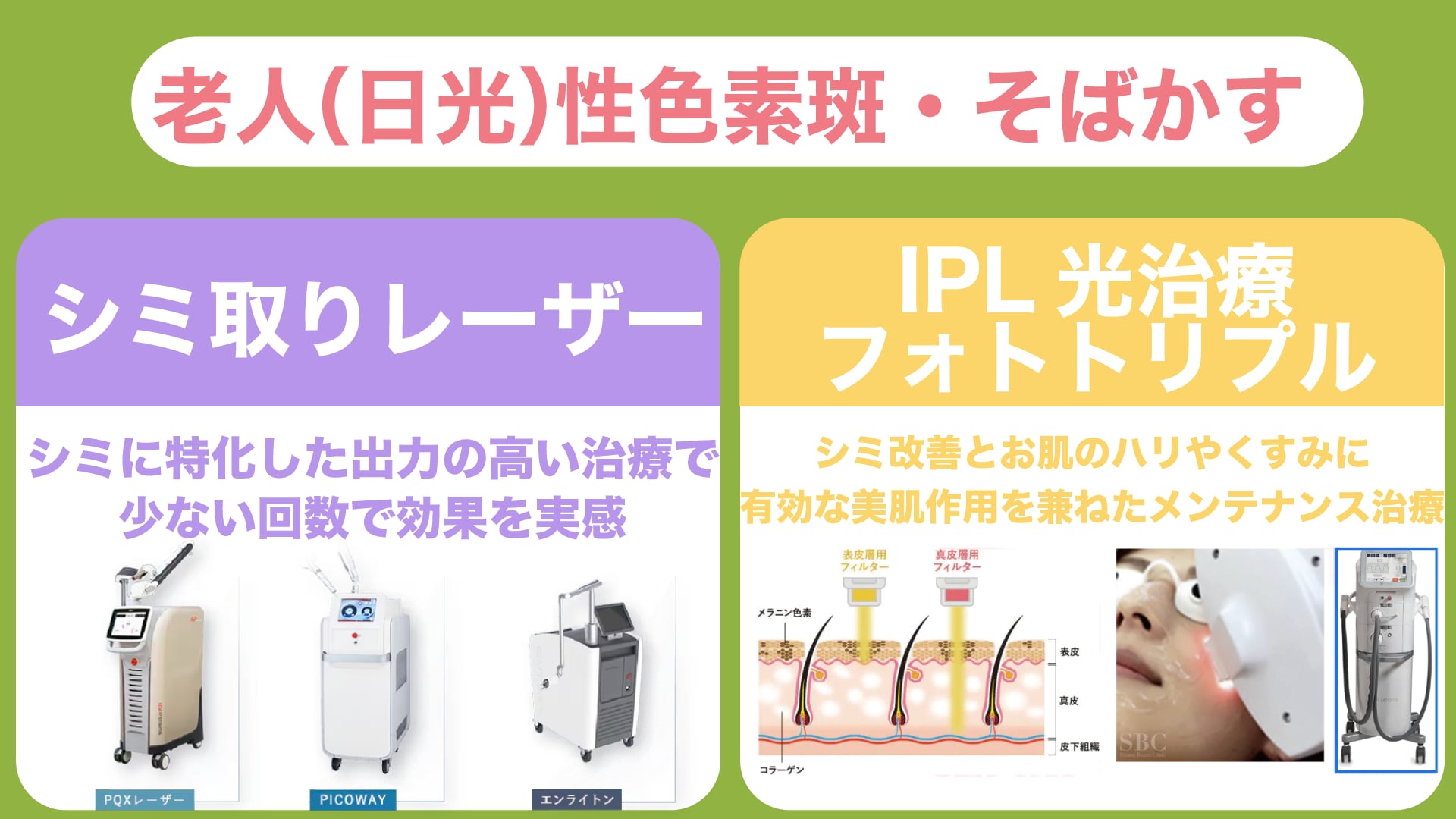 【日光性・老人性色素斑／そばかす】治療方法