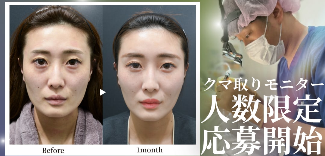 根本的に１回でクマ解決がしたい方必見！