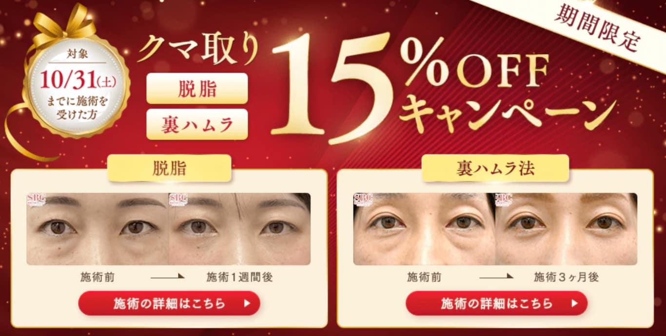 10月31日まで開催15％OFF「クマ取り」