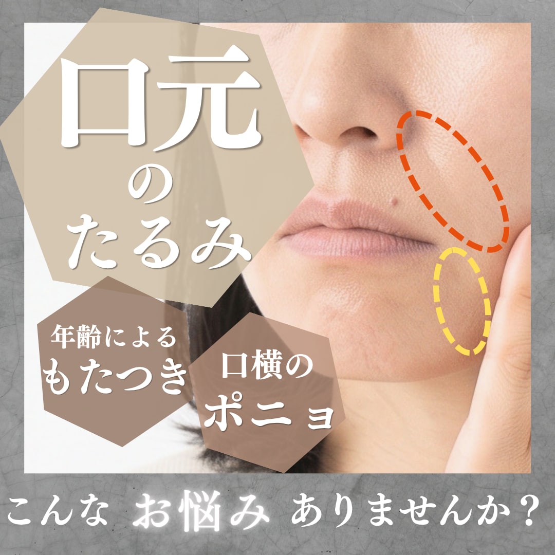 口横のポニョっとを改善できる！？最新美容針🪡
