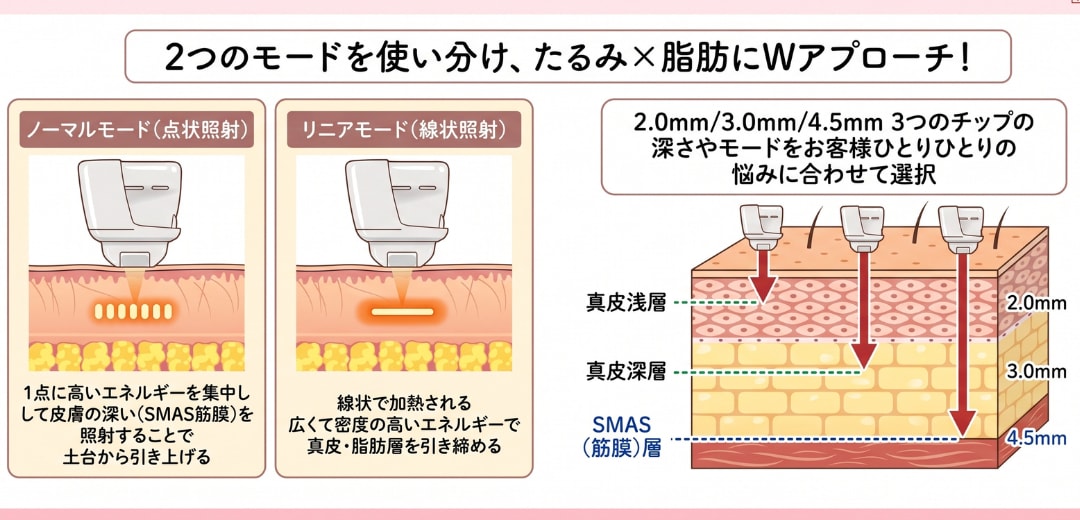 リニアモードを追加したSBCハイフプログラム
