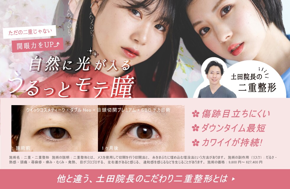 目の形にこだわる Dr.土田の目頭切開パークZ法