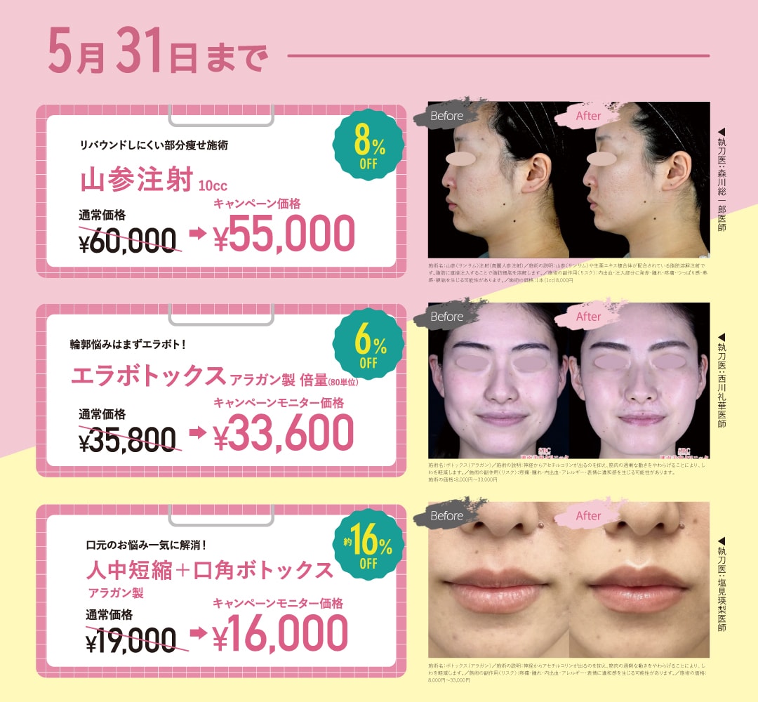 ボトックスや脂肪溶解注射が対象!
