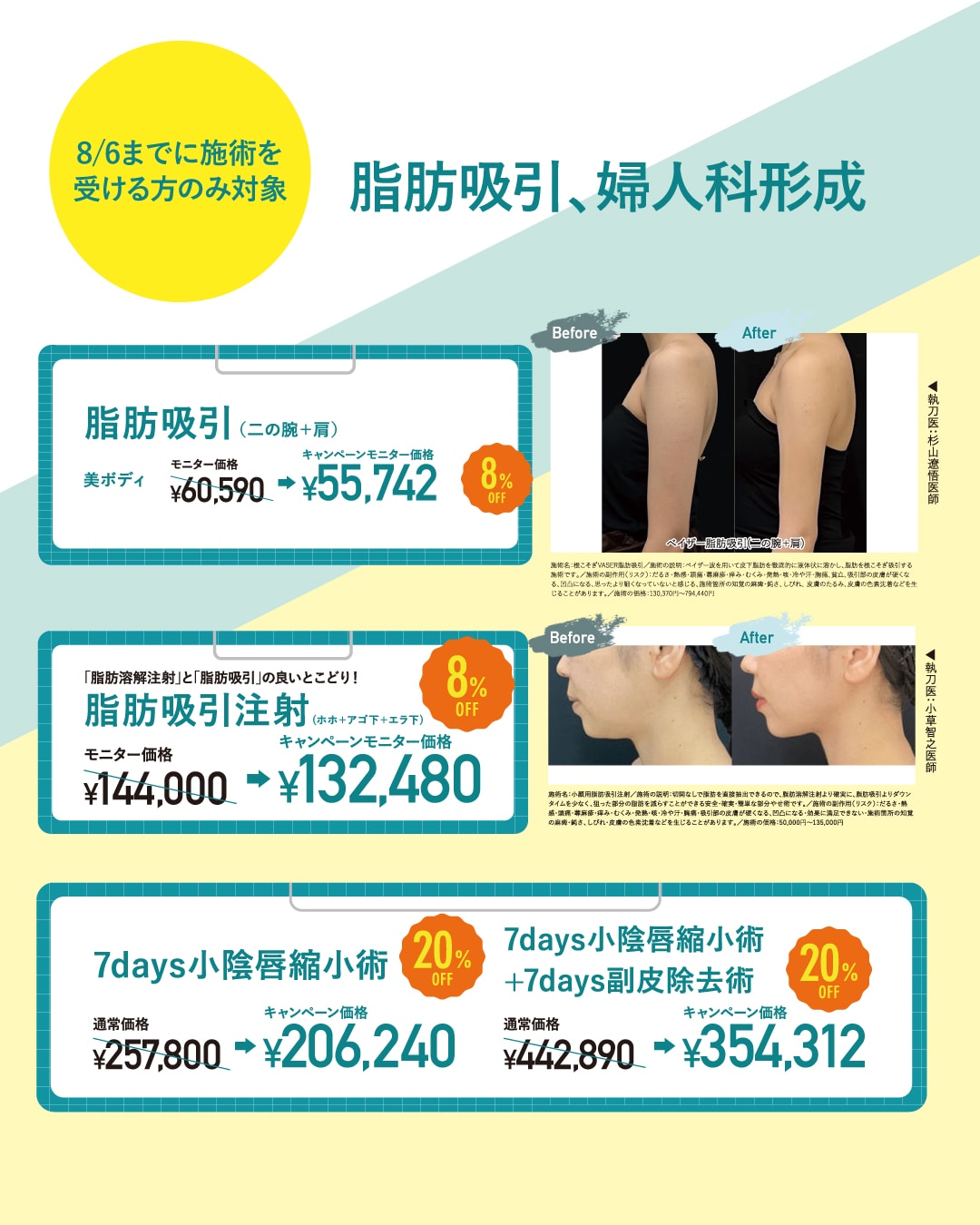 脂肪吸引、婦人科形成がお安くなってます!