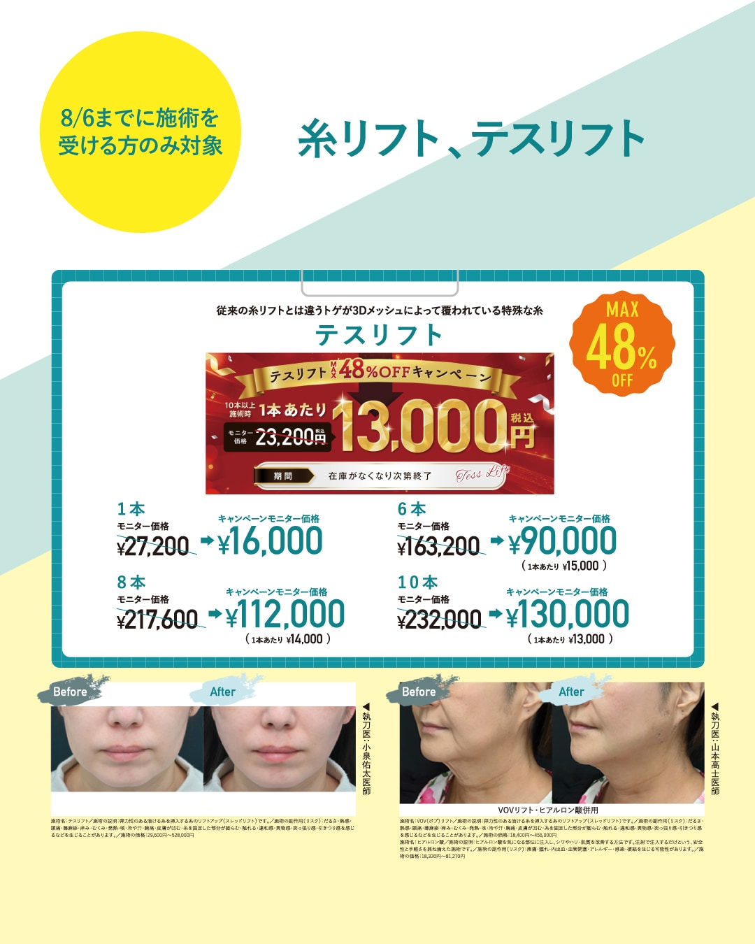 糸リフト(テスリフト)が更にお安く!