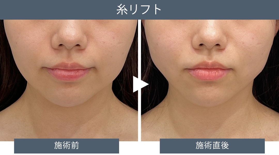 直後から自然な仕上がりを実現