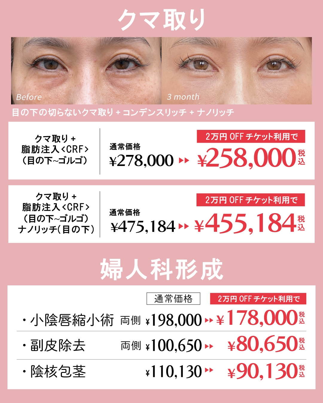 クマ取りや婦人科形成も2万円OFF