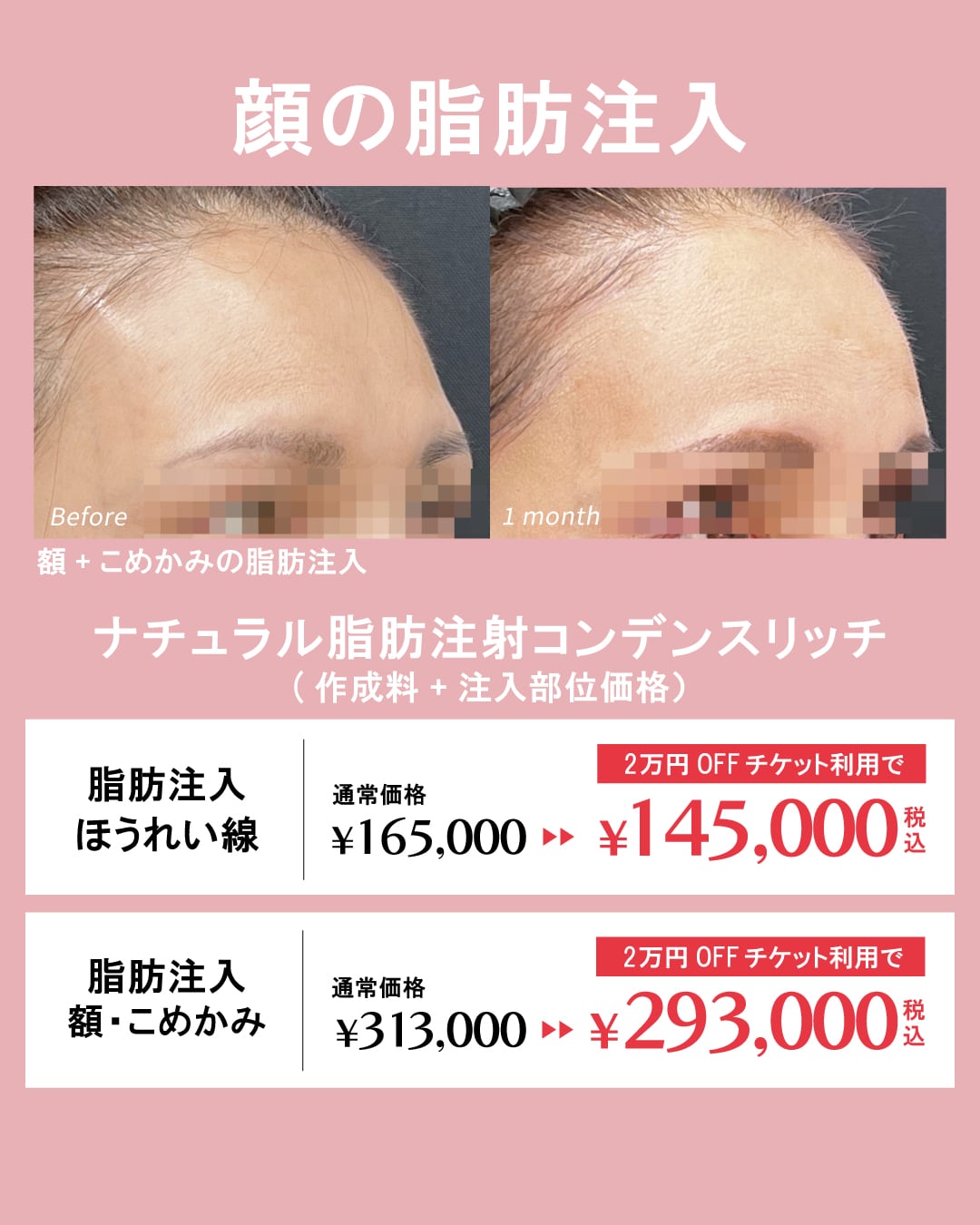 自然なのに-10歳若返り!