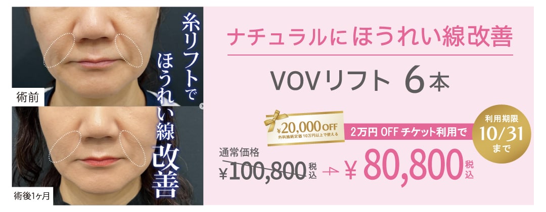 ほうれい線をナチュラルにリフトアップ!若々しい印象に