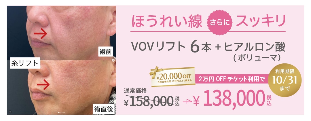 「引き上げ」と「補う」の相乗効果で、理想のフェイスラインへ