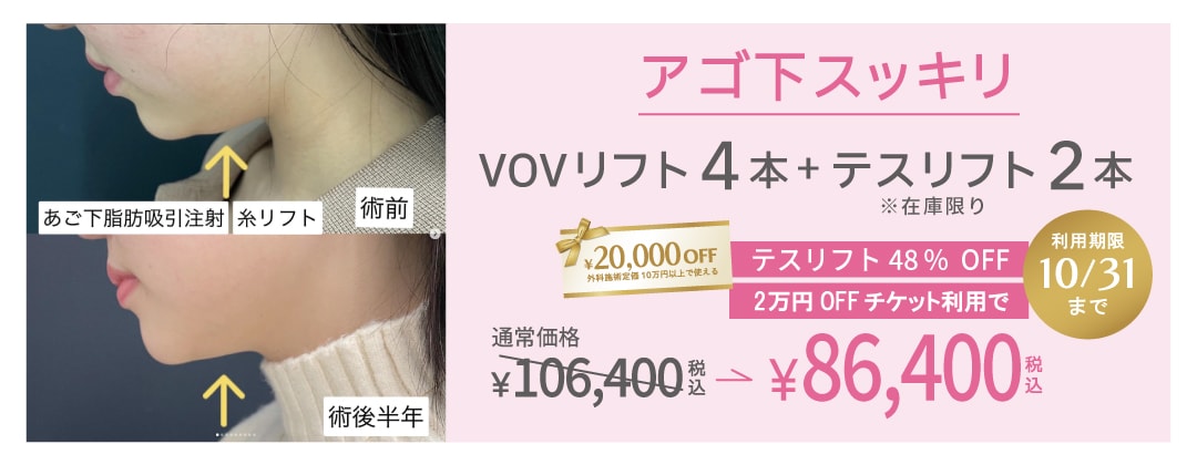 二重あご、フェイスラインをすっきりさせたい方