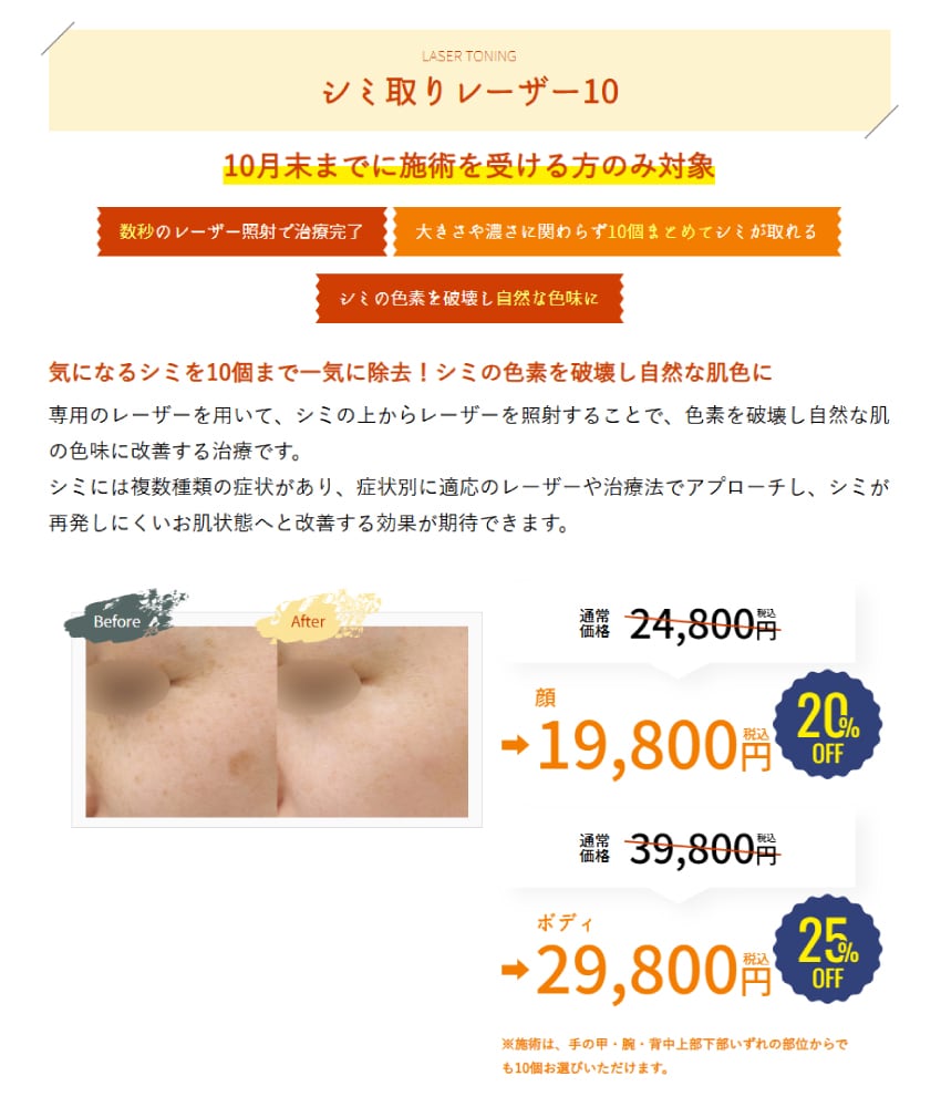大きさや濃さ問わず!気になるシミ10個まで