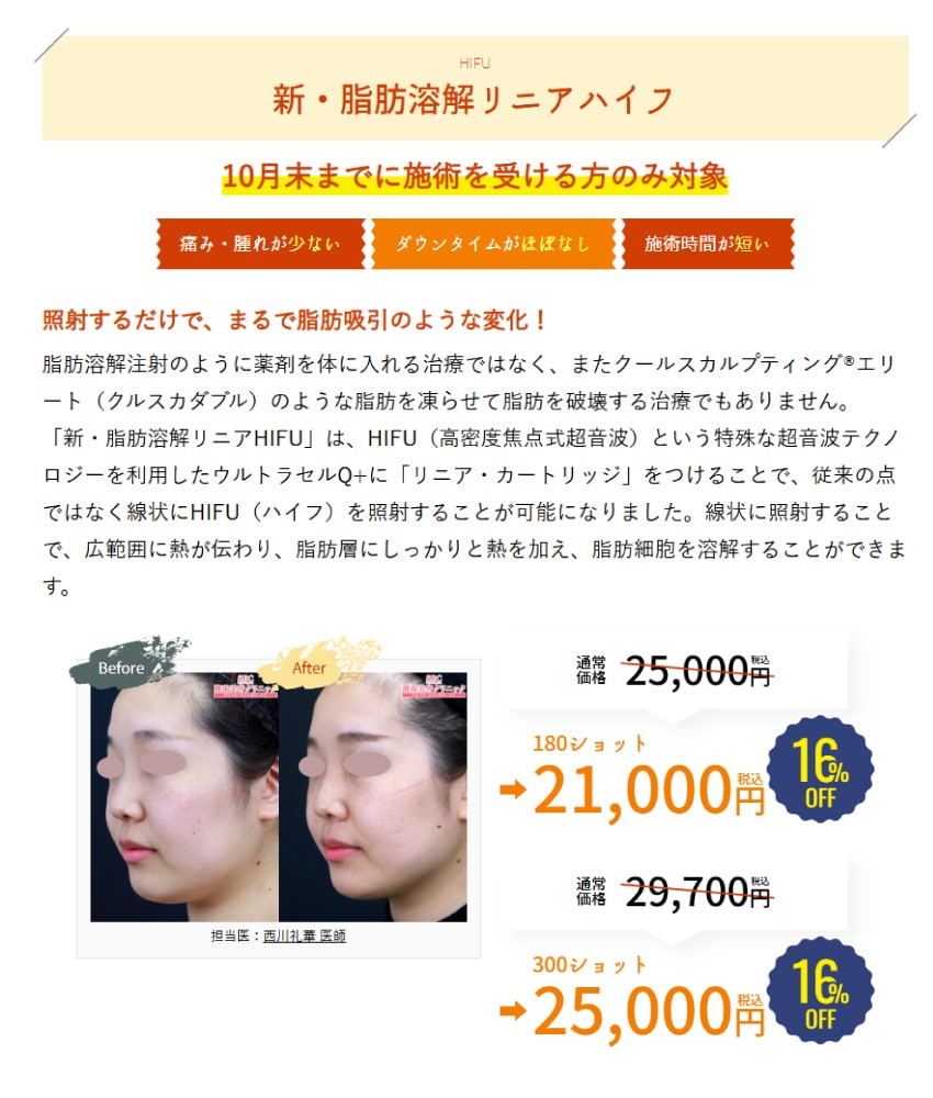 脂肪層に熱を加え、脂肪細胞を溶解する最新レーザー