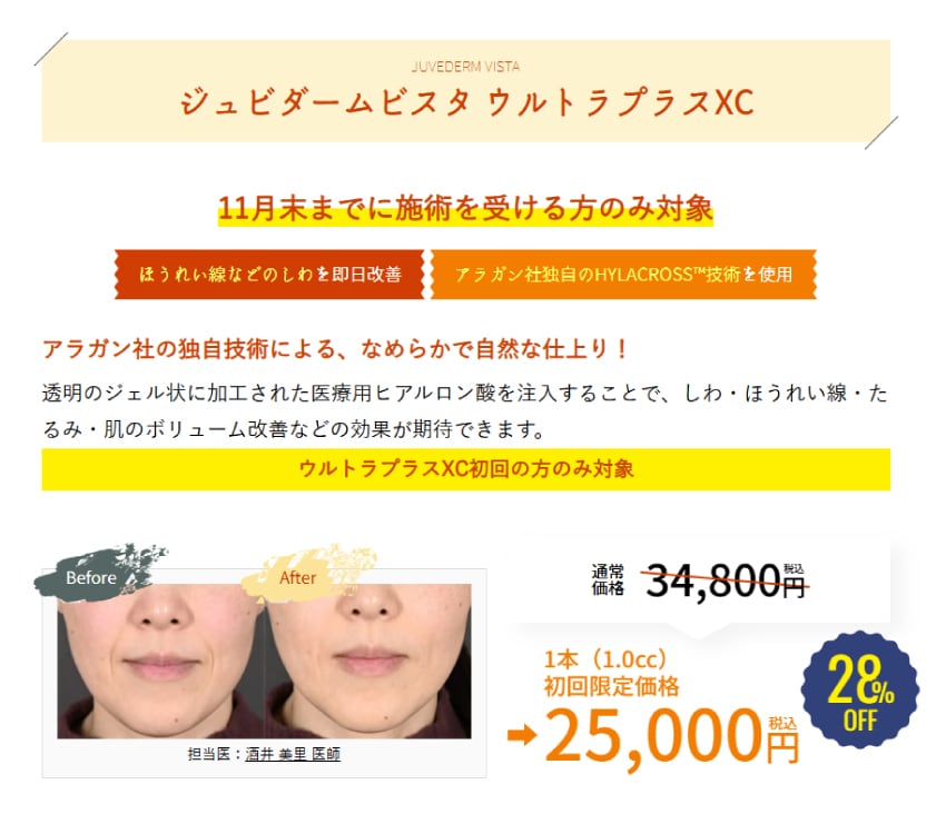 ※初回の方のみ対象※
