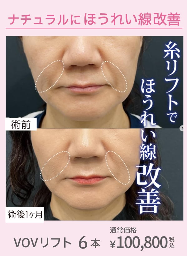 40代～美容】吹田市江坂でたるみ治療なら湘南美容クリニック - 江坂院