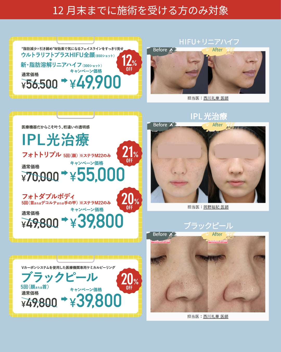 今月限定のおすすめキャンペーン