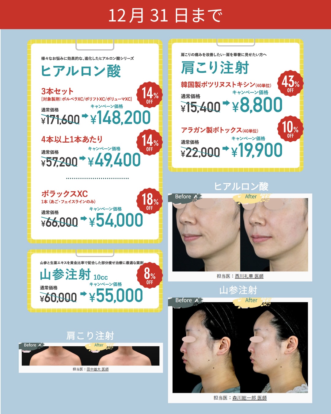 今月限定のおすすめキャンペーン